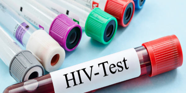एचआईवी के बारे में मूलभूत तथ्य 